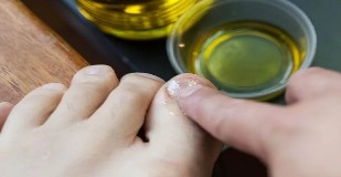 Essential oils to fight fungus